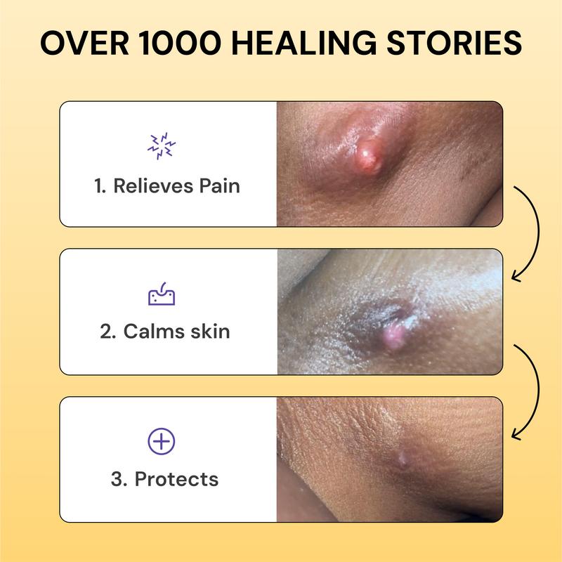 LS | Universal Flare Care