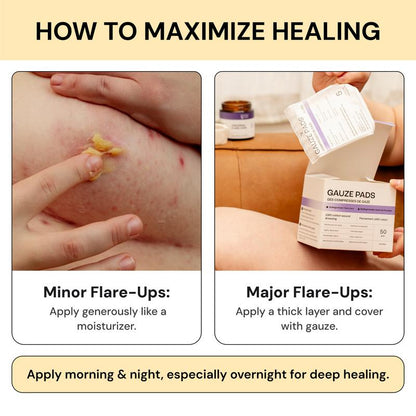 LS | Universal Flare Care