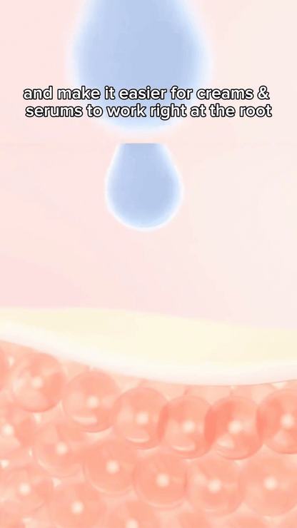 LS | Microneedle oogpads 1 + 1 gratis