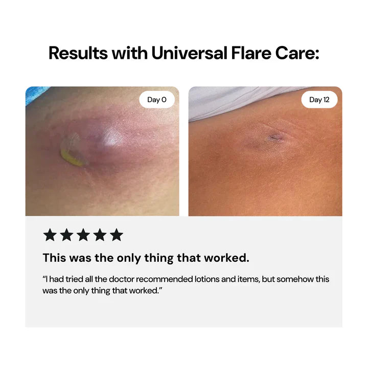 LS | Universal Flare Care