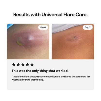 LS | Universal Flare Care