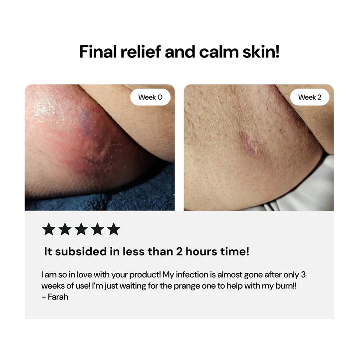 LS | Universal Flare Care