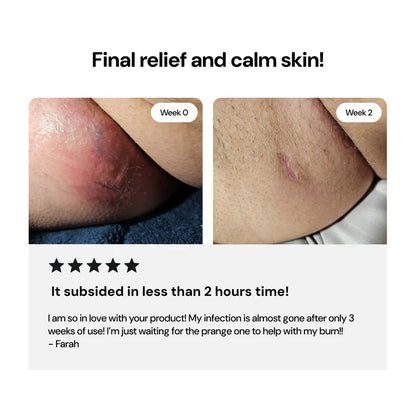 LS | Universal Flare Care