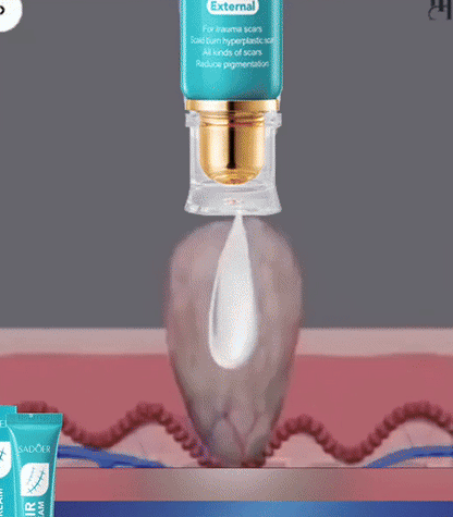 LS | Littekencrème